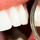 Seguro dental
